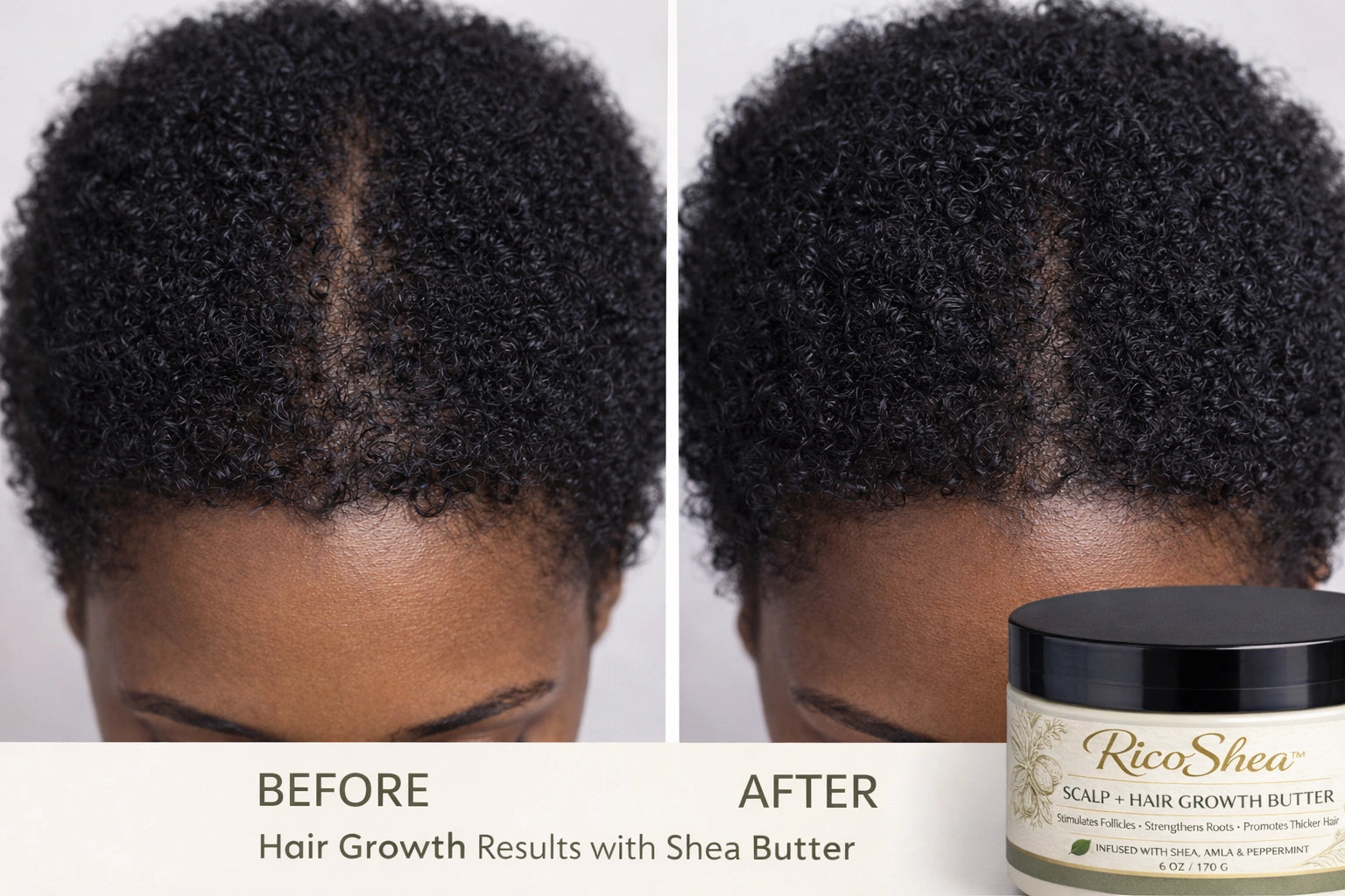 RicoShea™ Scalp + Hair Growth Butter | Natural Hair Care Routine