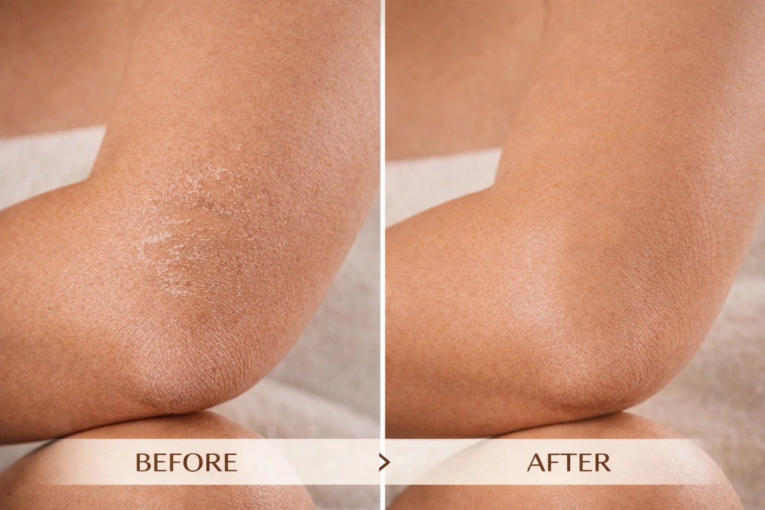 RicoShea™ Intensive Repair Body Butter